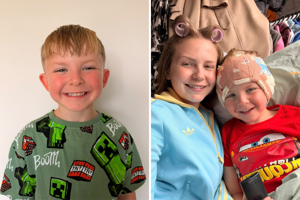 Boy, 5, Has Cosmetic Surgery—Mom Says She’d Make the Same Choice Again