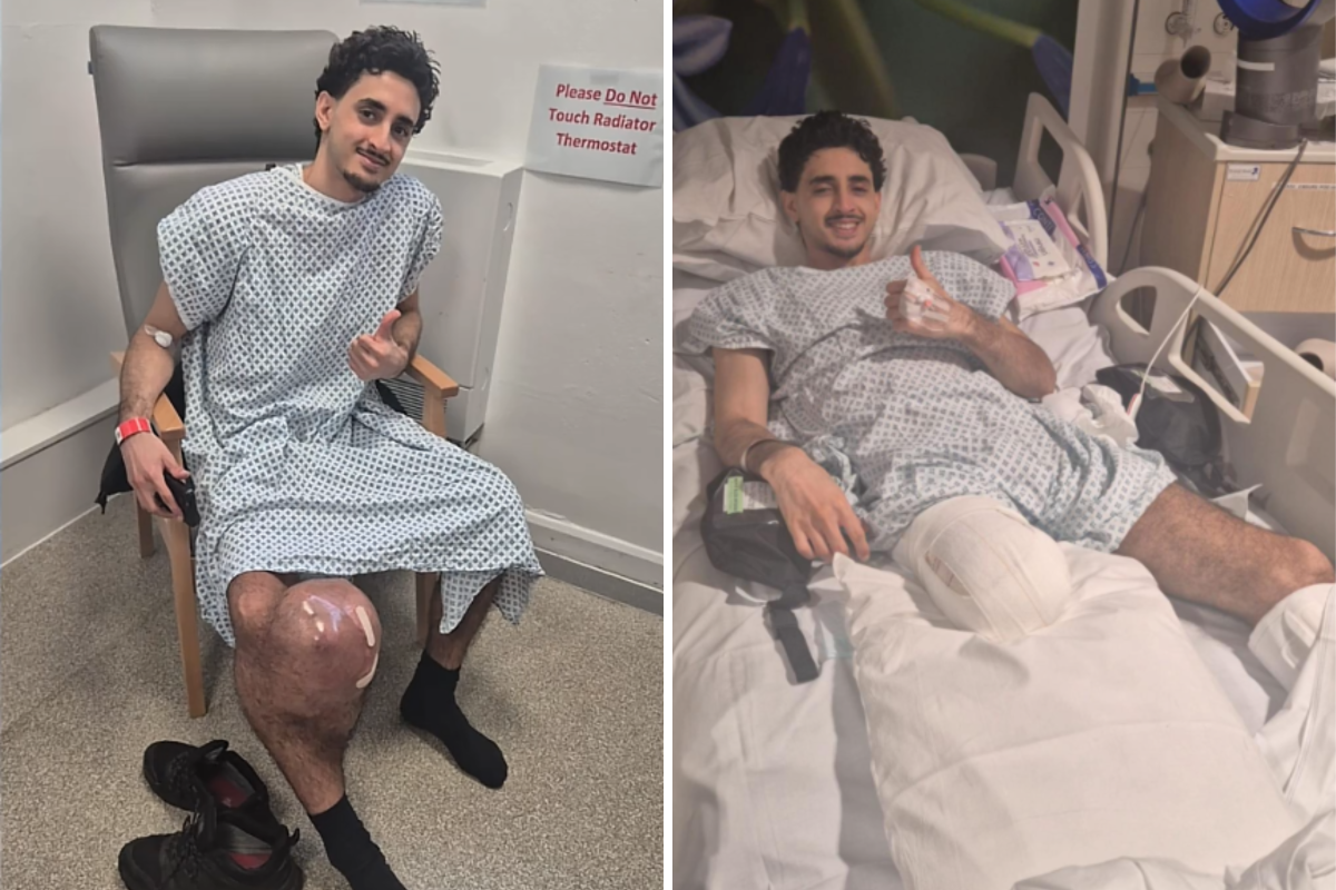 Man Notices Small Lump on Knee, Then Faces Life-Saving Decision Man Notices Small Lump on Knee, Then Faces Life-Saving Decision