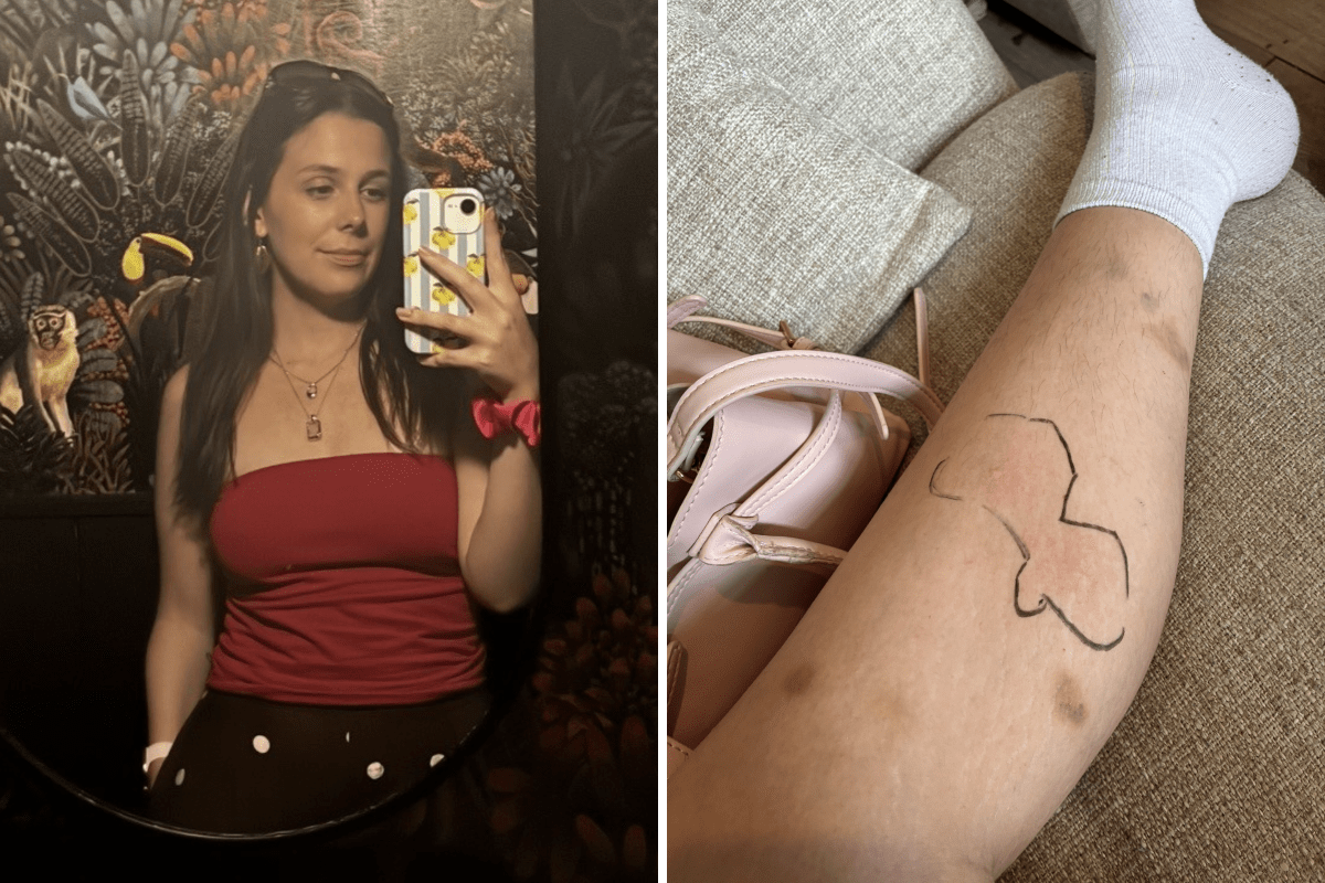 Woman Ignored Her ‘Normal’ Symptoms for Years, Then Everything Changed