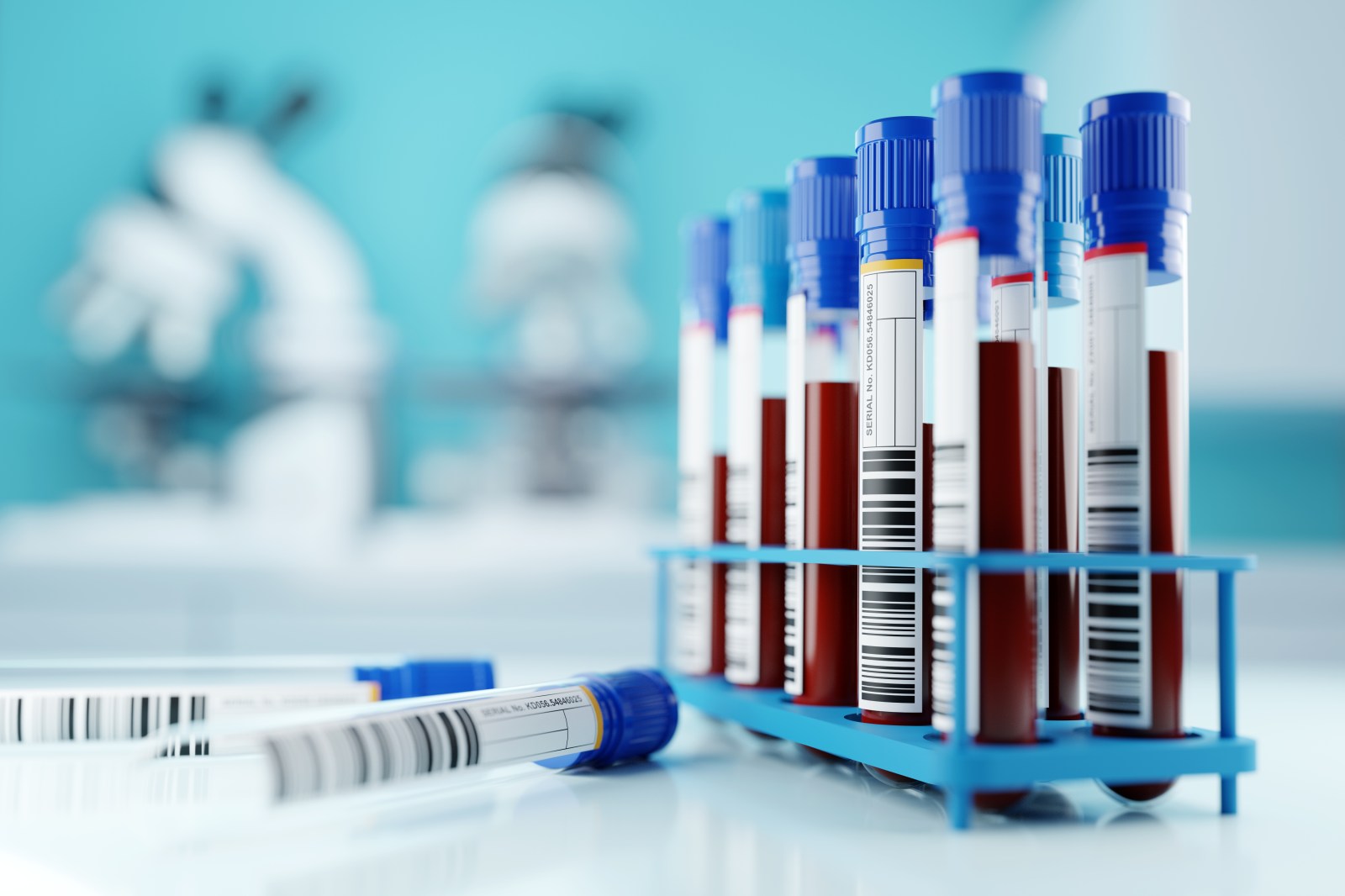 newsweek.com - Maria Azzurra Volpe - New blood analysis could show if colon cancer will return-before symptoms