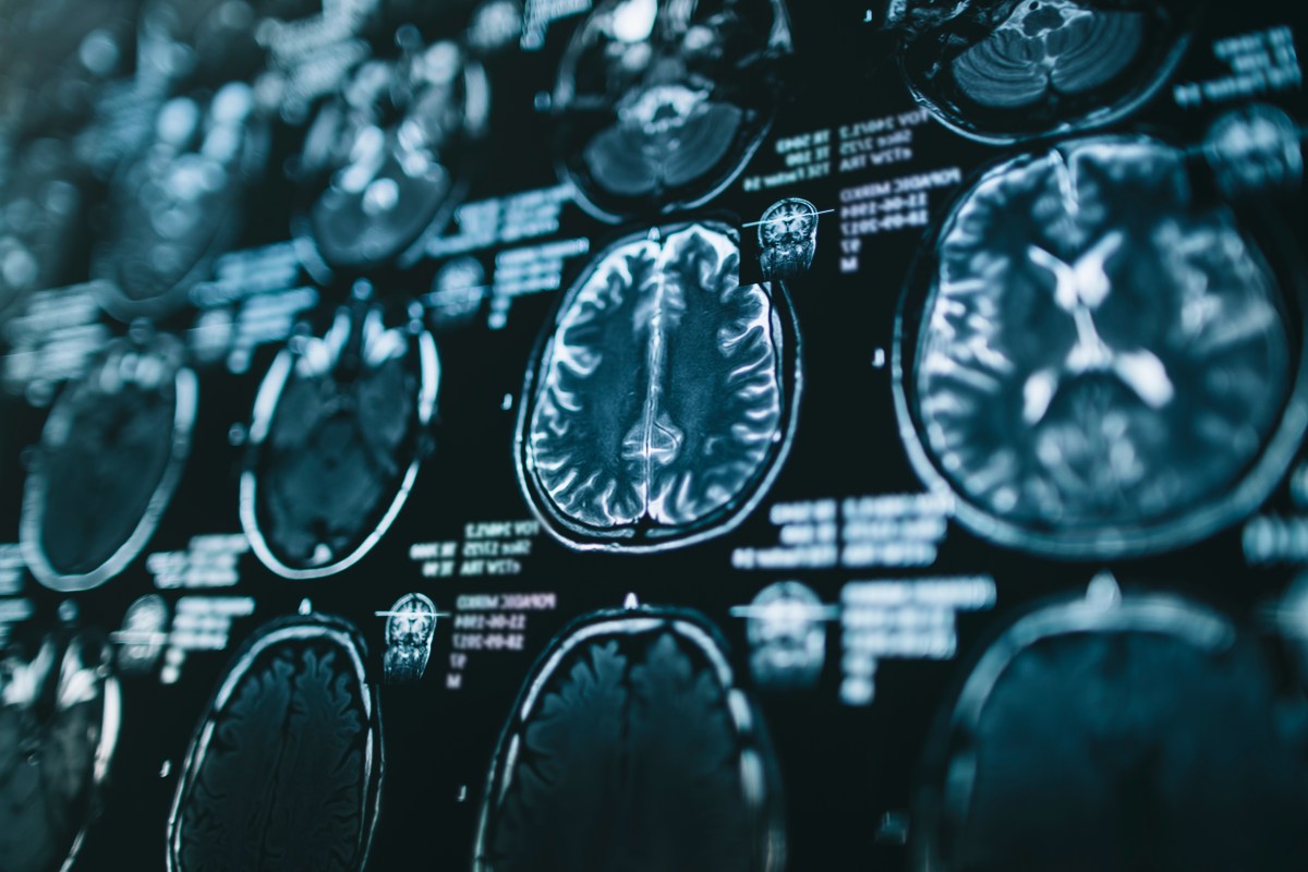 Scientists Discover Hidden Brain Structure That Could Help Fight Alzheimer’s