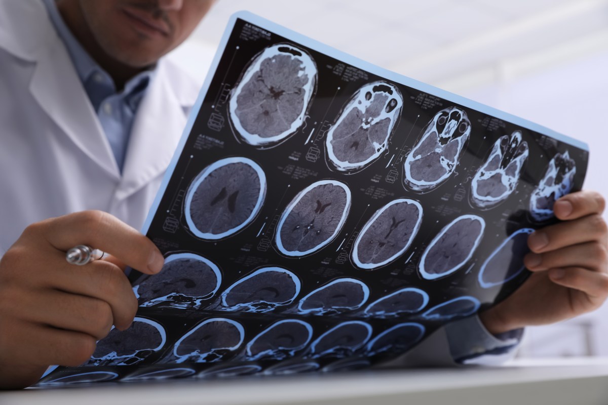 One Childhood Diet Habit Was Linked to a 46% Lower Alzheimer's Risk