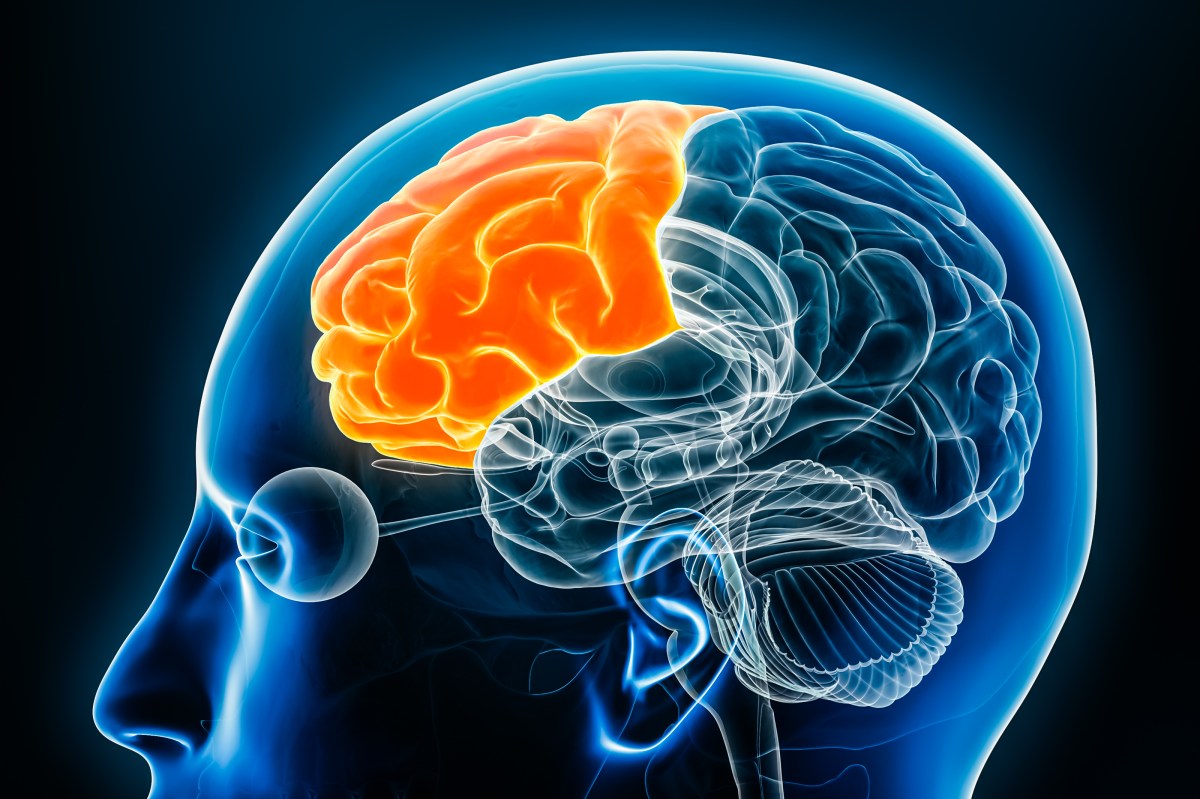 Dementia Can Strike Before 65—One Group May Be More Affected Than Thought