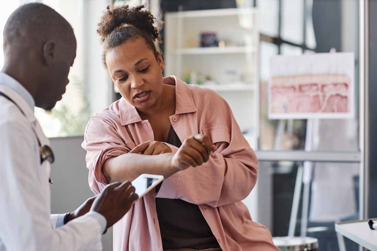 I’m a Doctor, Here Are The Hidden Signs You May Have an Autoimmune Disease