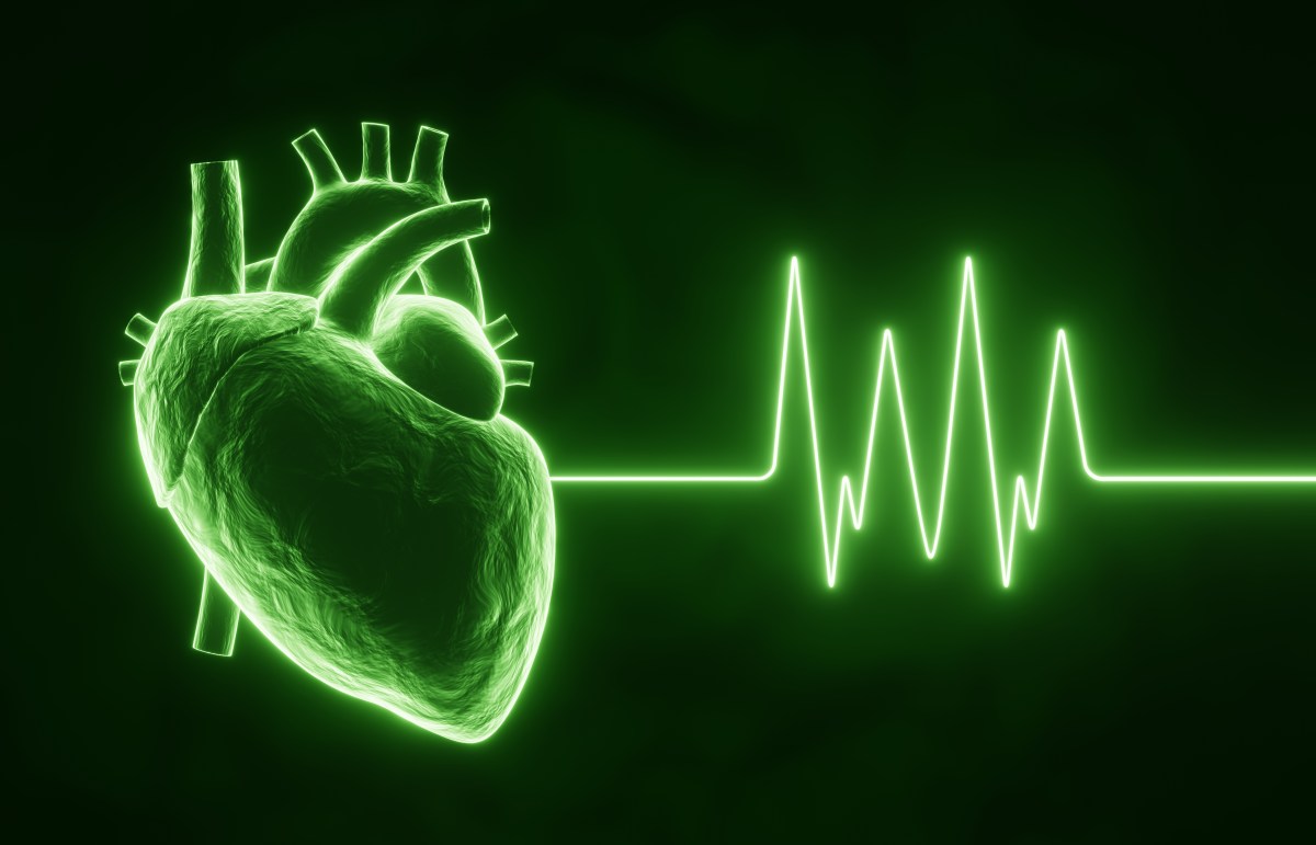 Why Traditional ECG Training May Be Failing Clinicians