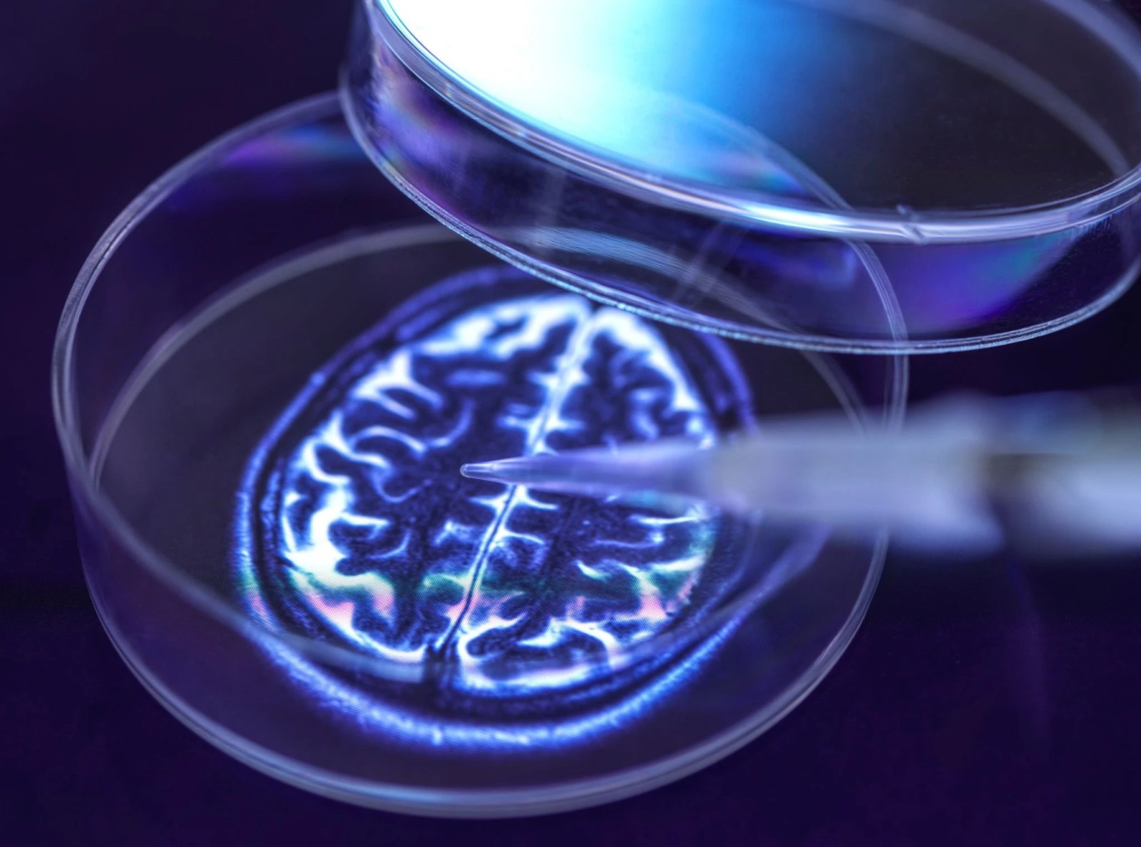 newsweek.com - Maria Azzurra Volpe - Scientists find brain change that may predict future dementia