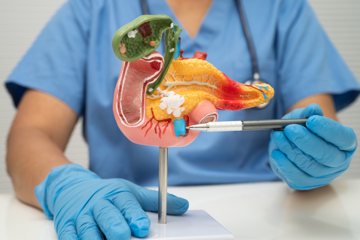 The Cancer With the Lowest Survival Rate May Finally Have an Early Test