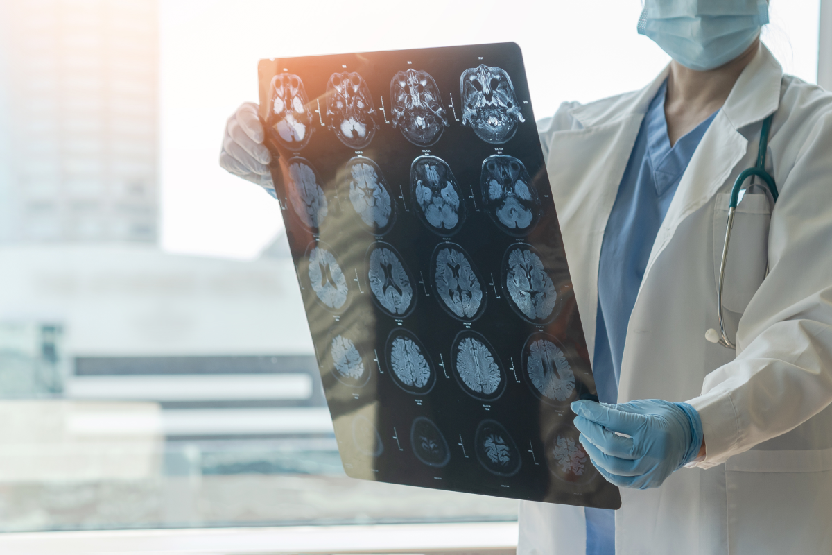 Scientists Find Drug That May Fight Alzheimer's on Multiple Fronts