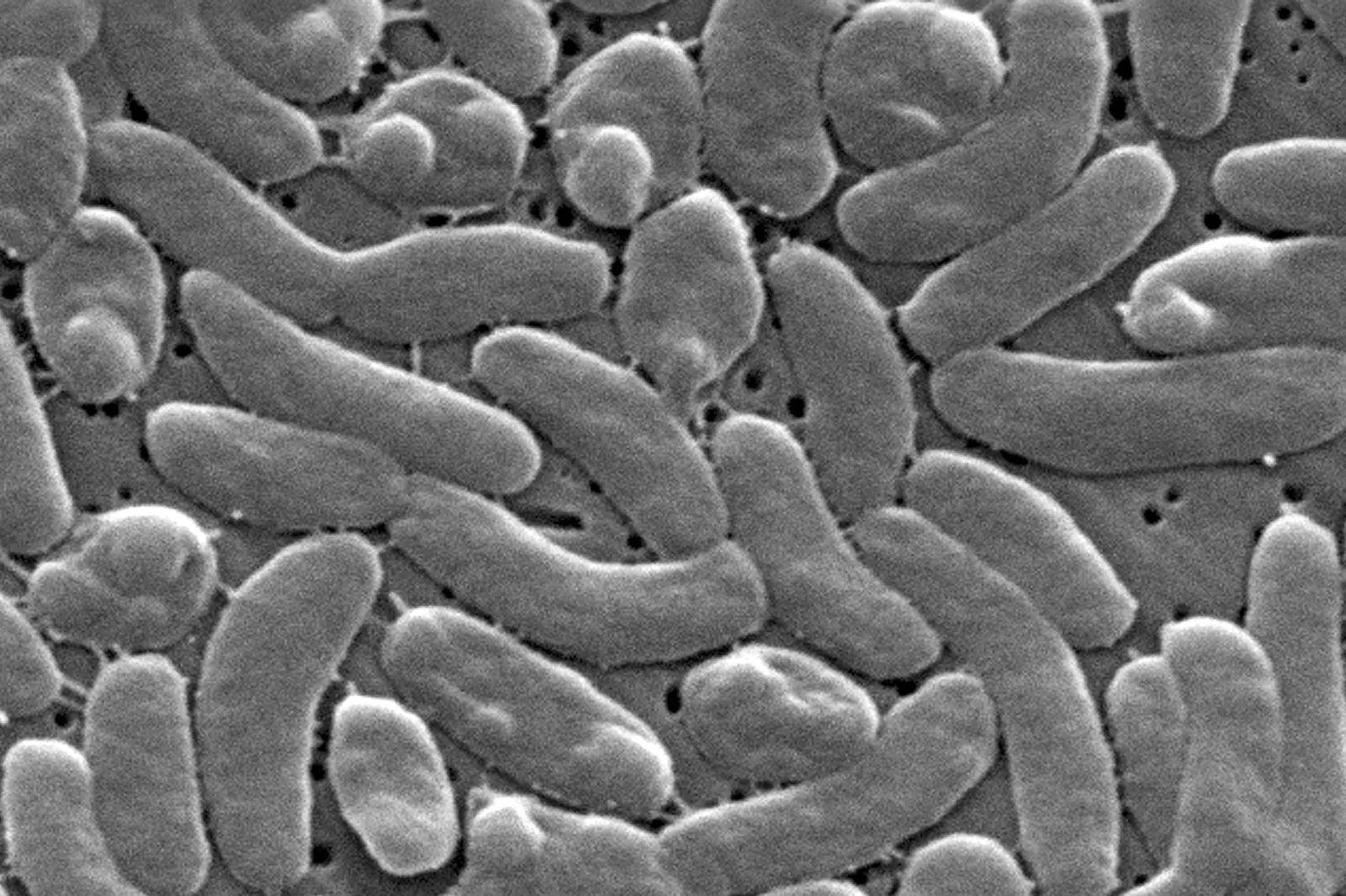 Image for article: Deadly ‘Flesh-Eating’ Bacteria Kills 6 As Alerts Issued In Multiple States