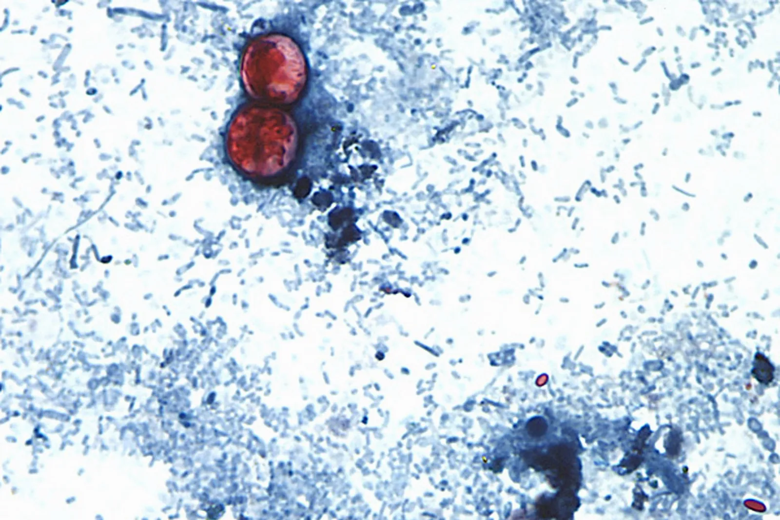 Esta fotografía tomada a través de un microscopio y difundida por los CDC muestra Cyclospora cayetanensis oocysts de una muestra de heces. (CDC vía AP, Archivo)