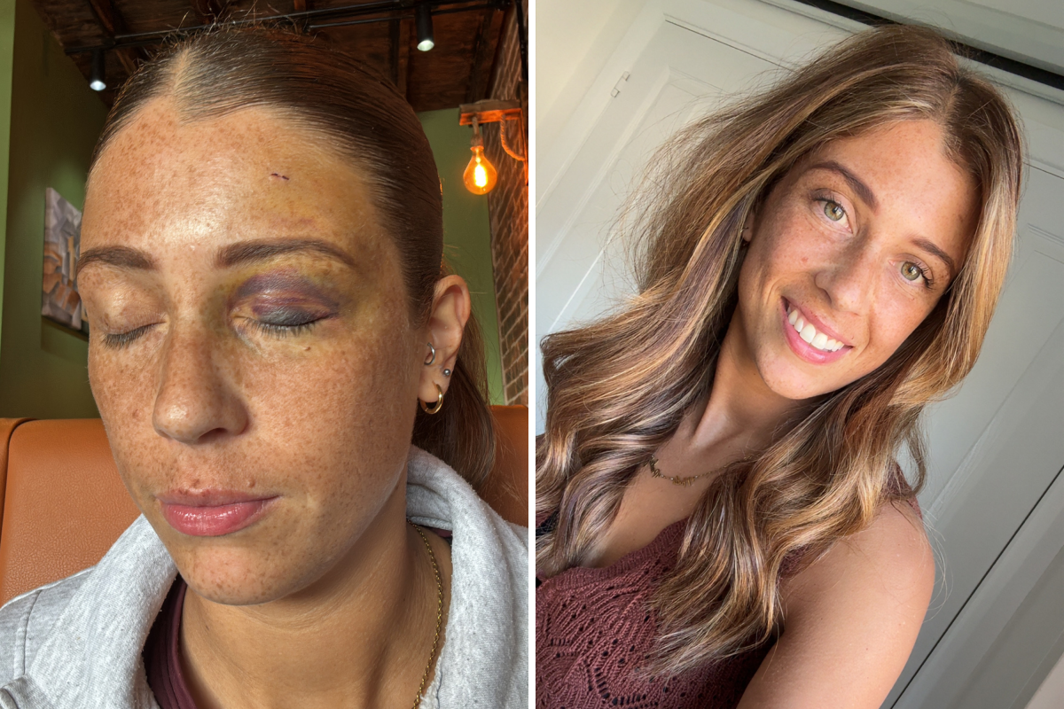 Woman Stopped Contraception Injection—Then Her Health Took Devastating Turn
