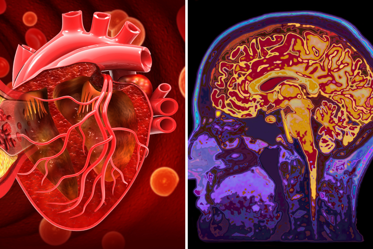People Without These 3 Risk Factors Lived 13 More Years Without Dementia