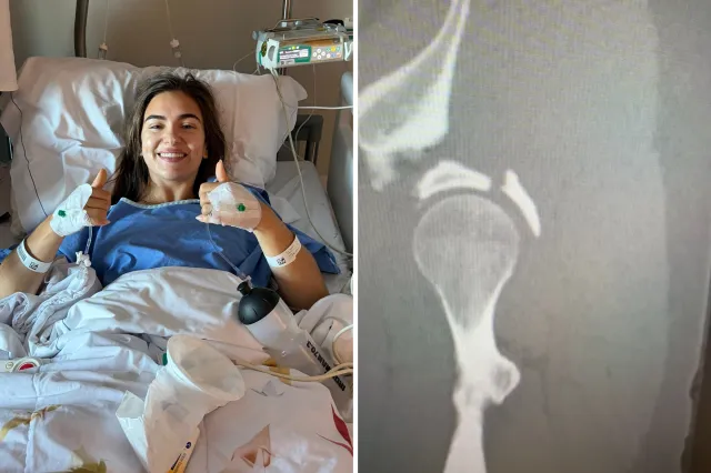 From left: Elissa Simpson lies in hospital, and an X-ray scan of her right hip is seen.