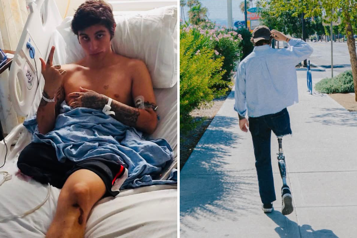At 16, I Jumped on the Train Tracks. The Consequences Were Devastating