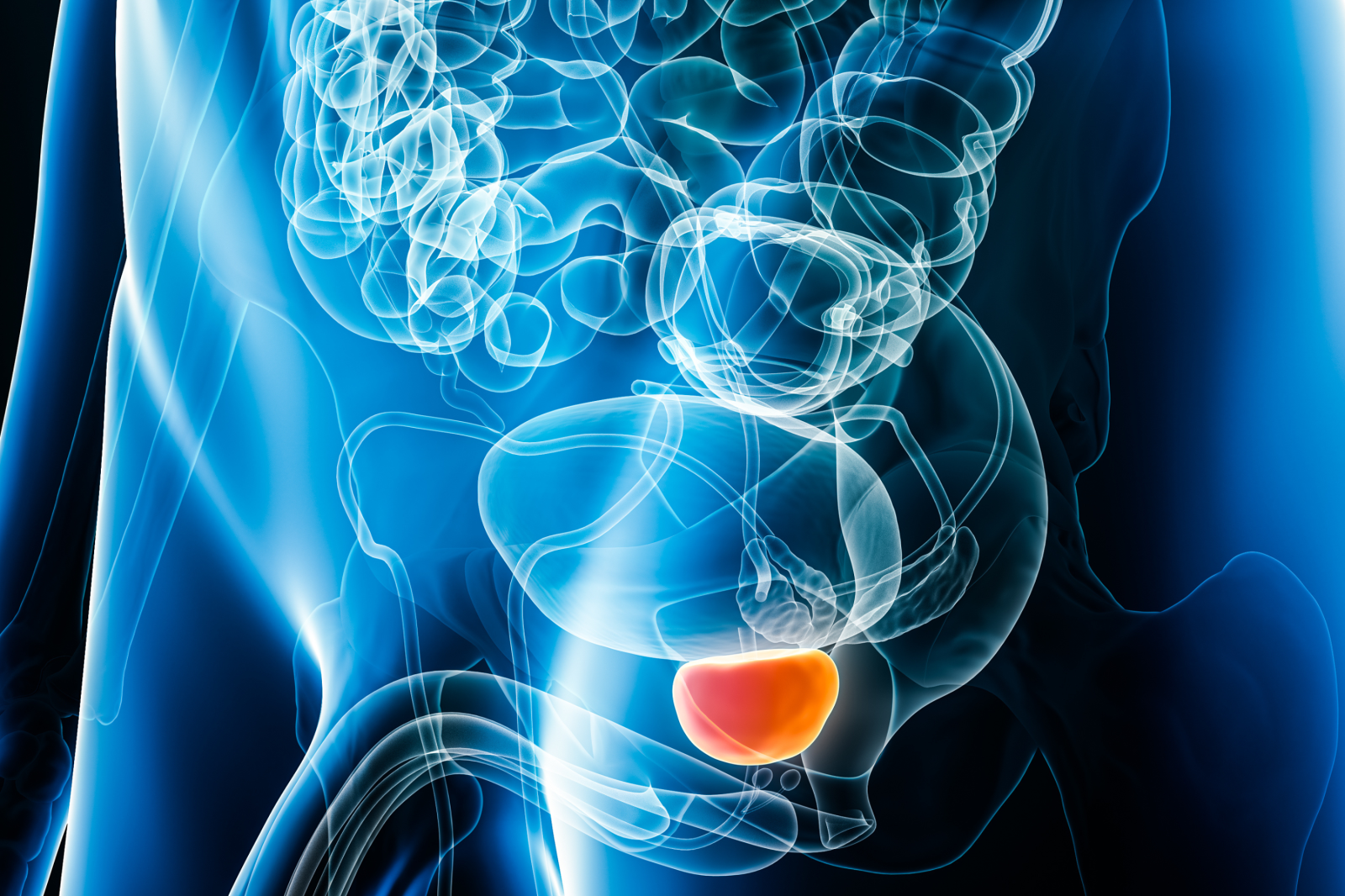 newsweek.com - Daniella Gray - Foods making up most Americans' diets linked to higher prostate cancer risk