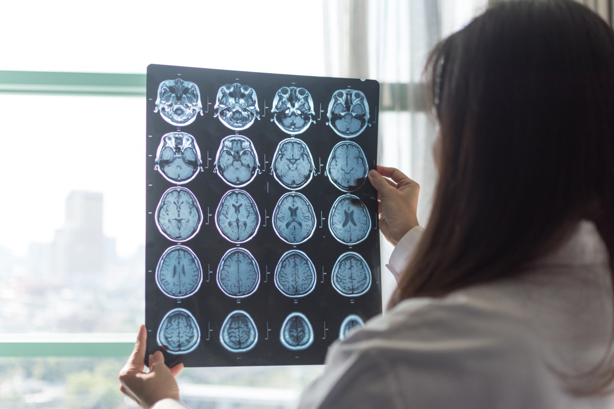 Researchers Uncover New Lifestyle Factor That Could Affect Alzheimer’s Risk