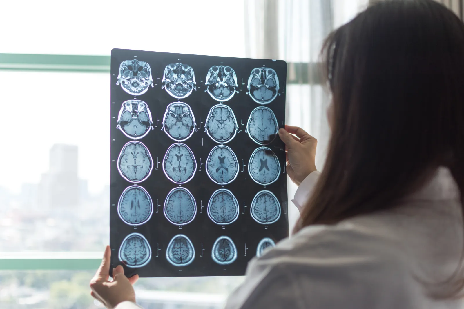 A stock image shows an MRI digital X-ray of a brain with a radiologist working in the hospital.