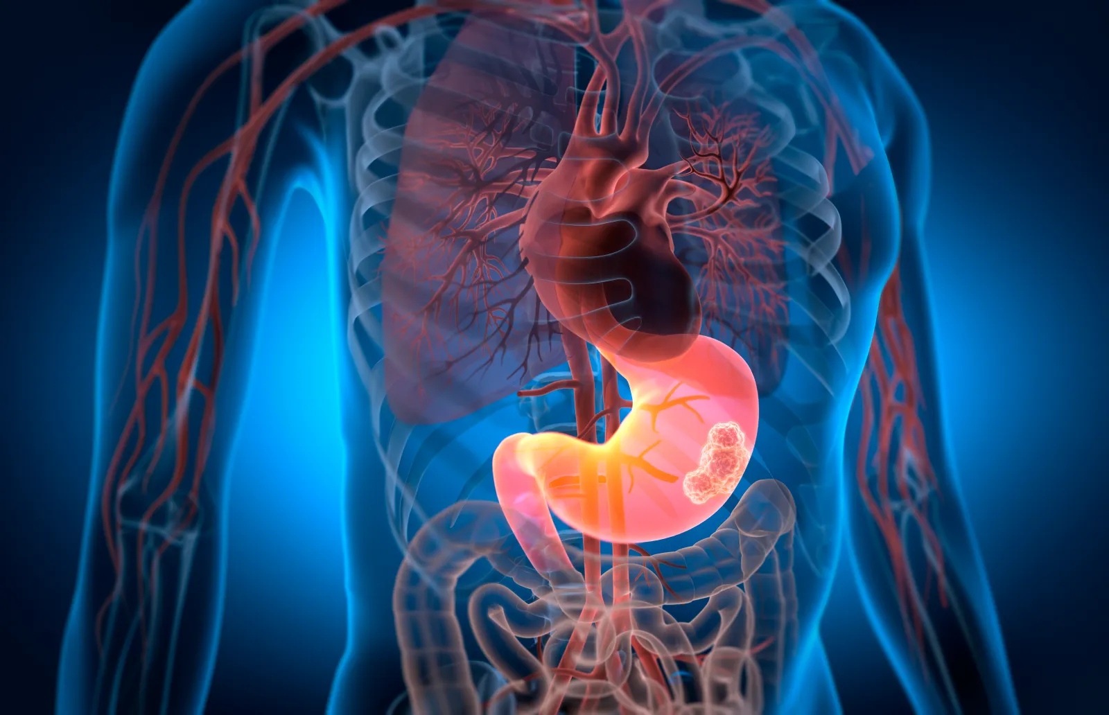 Major Cancer Breakthrough Could Help More Patients Than Previously Thought