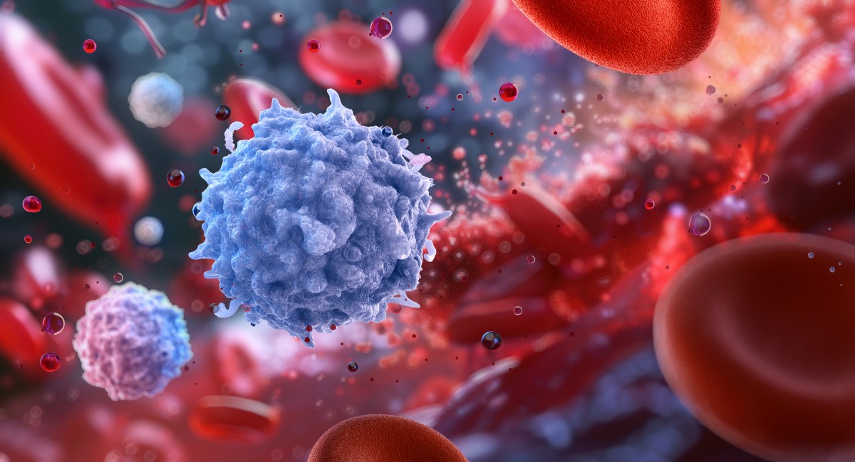Scientists Find Blood Clue That May Predict Who Survives Common Cancer