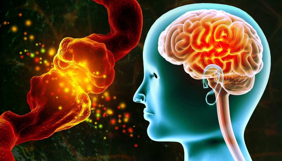 Brain Test Could Predict Dementia Before Doctors Can See It, Study Suggests