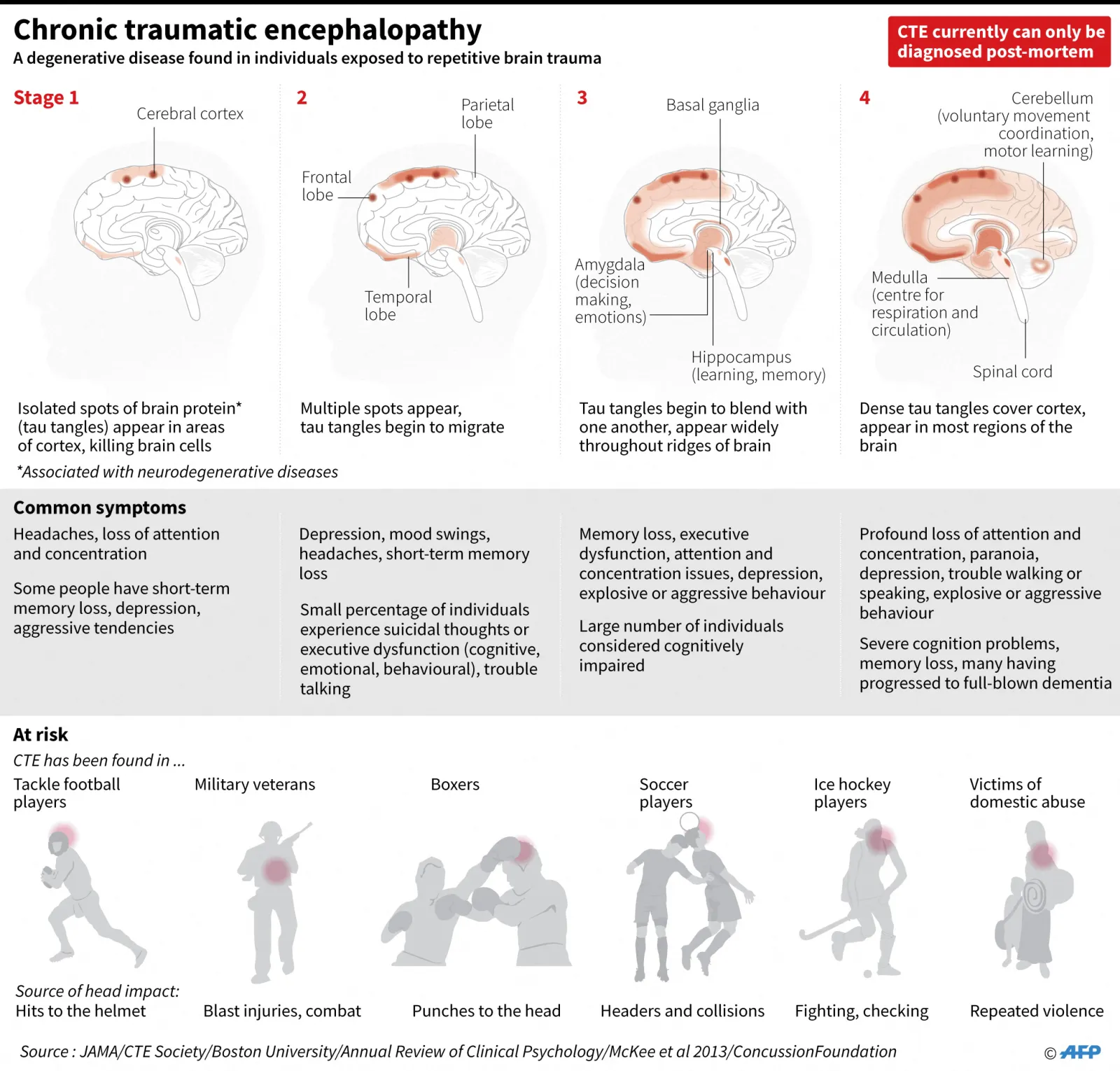 Graphic on the stages of chronic traumatic encephalopathy, a degenerative disease found in individuals exposed to repetitive brain trauma. (Graphic by Gal ROMA and Laurence CHU / AFP via Getty Images)