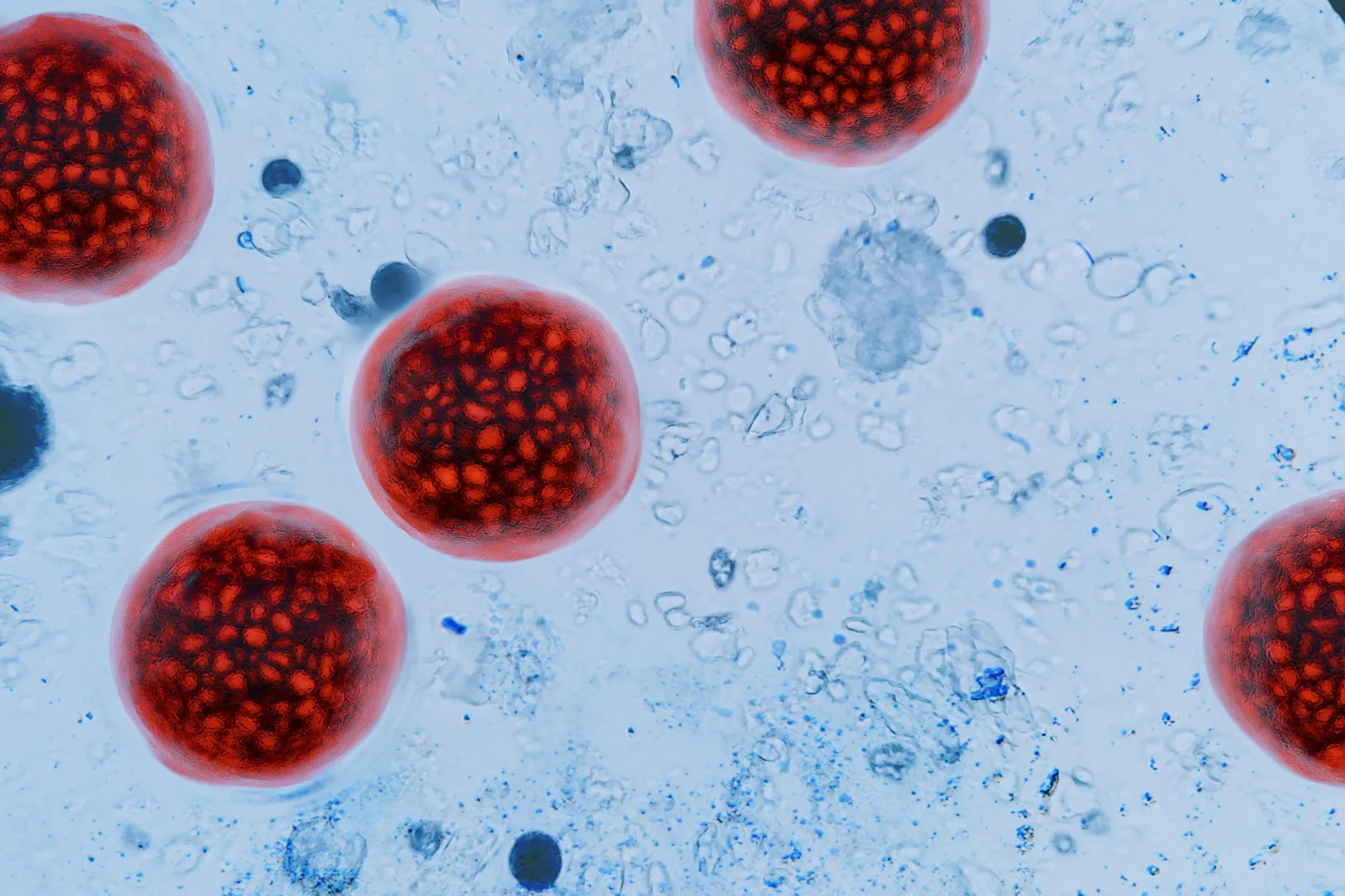 Millions of Illnesses Linked to Foodborne Parasites in New Research