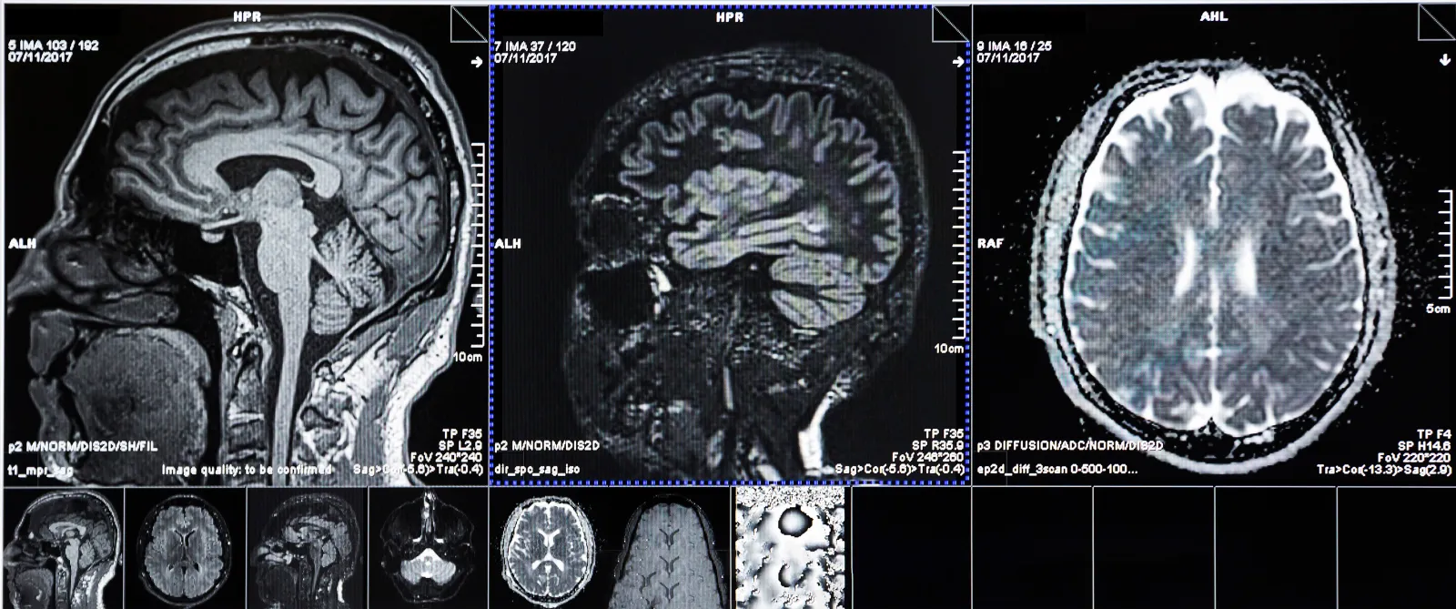 CT scans of human head on a ultrasound computer monitor.