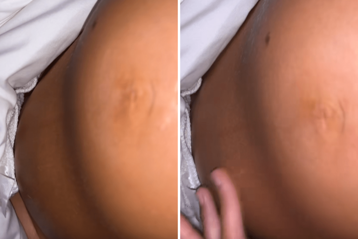 Mom-to-Be Panics at What’s Seen on Pregnancy Bump—Then Doctors Reveal Truth