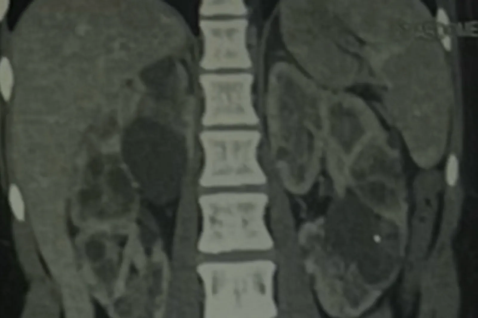 New Mom Gets CT Scan After Giving Birth—Then Comes Life-Changing Diagnosis