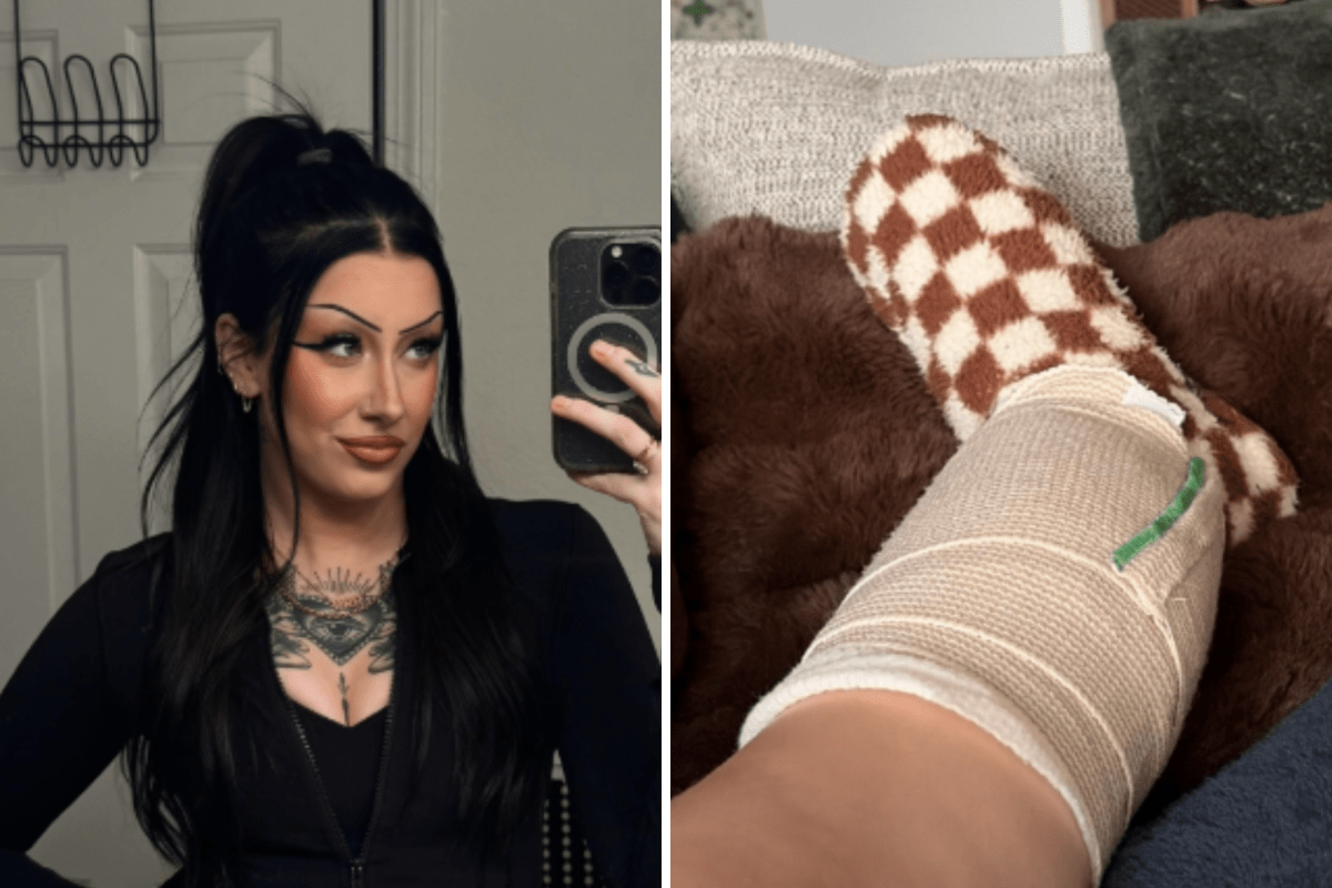 Woman, 26, Thought Her Leg Was Just Itchy, Then Came Nightmare Diagnosis