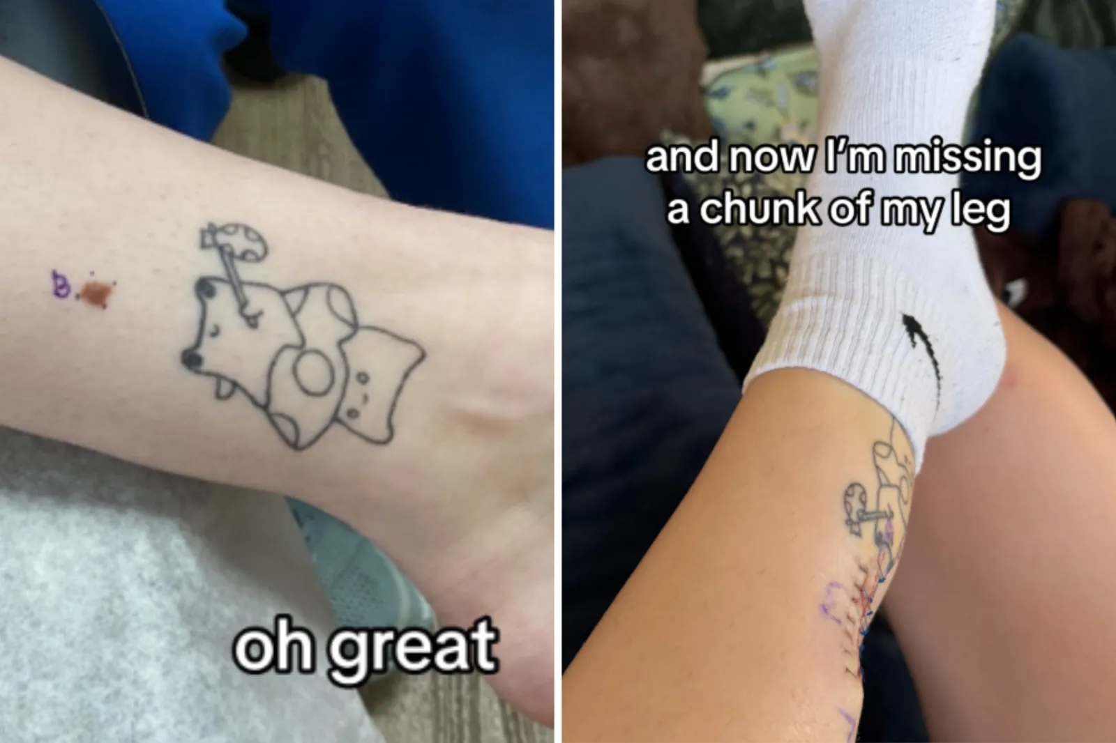 The mole and her leg after the surgery.