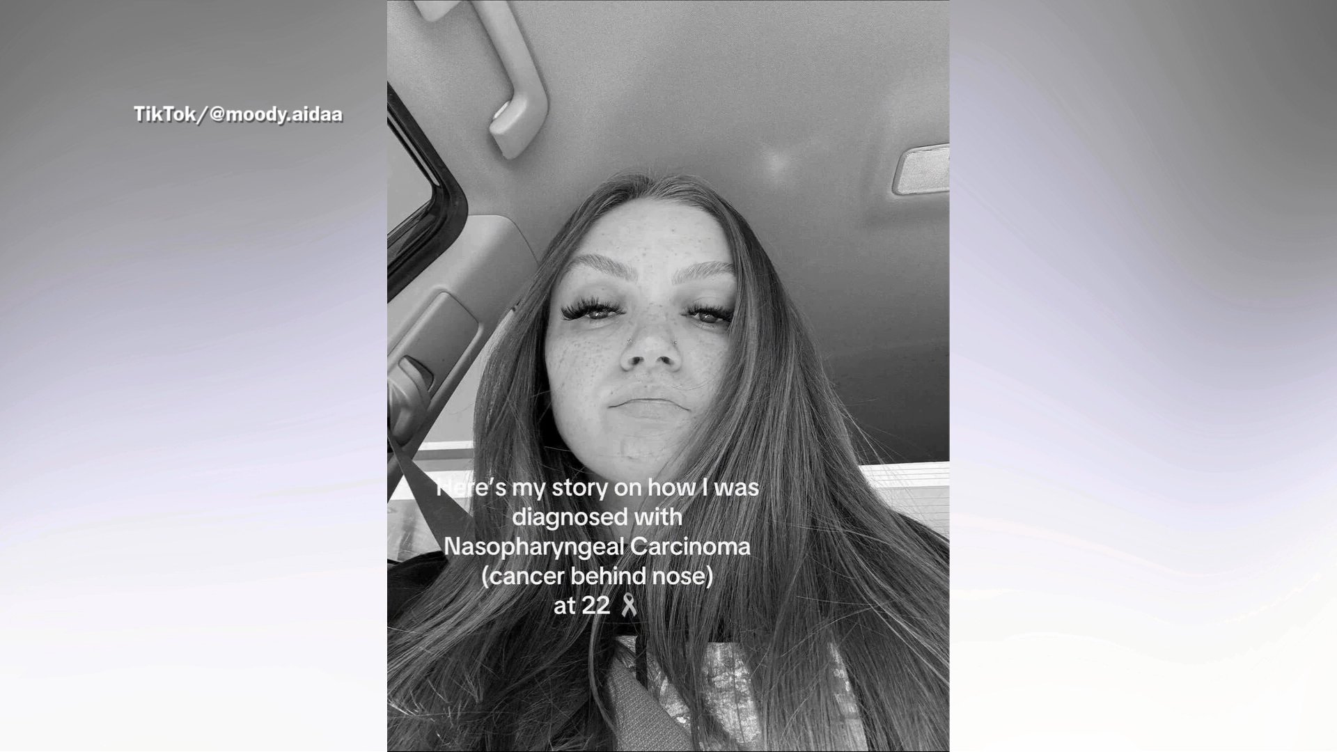 Woman Notices Ear Didn’t Pop After Flight, Leads to Horrifying ...