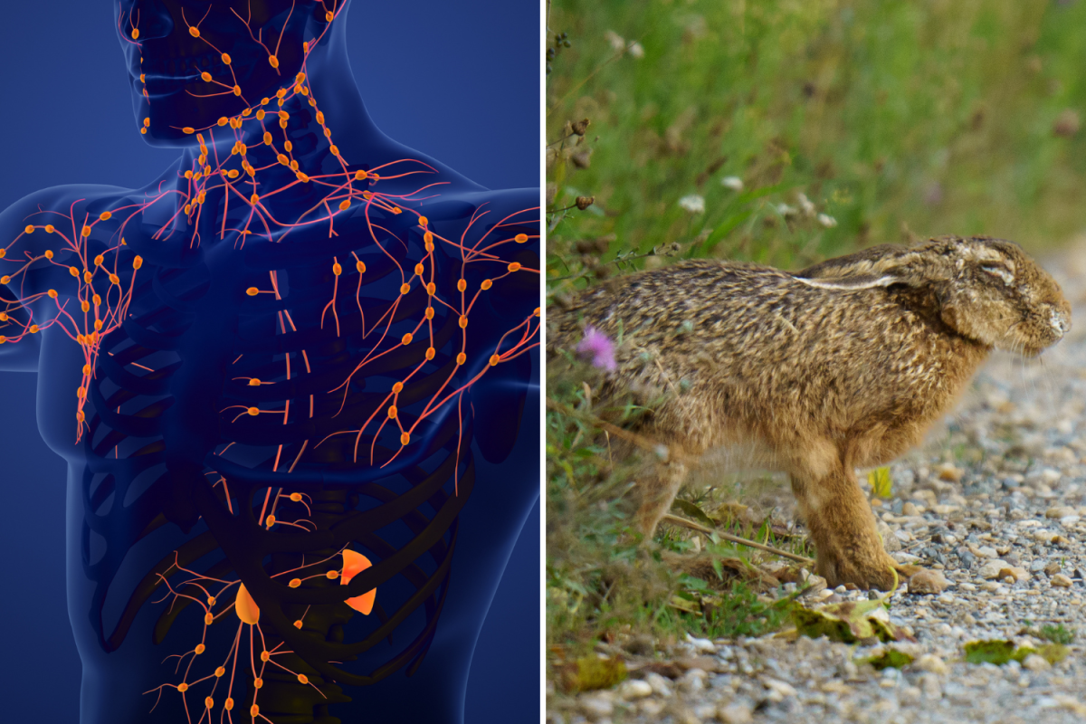 &lsquo;Rabbit Fever&rsquo; Symptoms Explained As Suspected Cases Hit New York