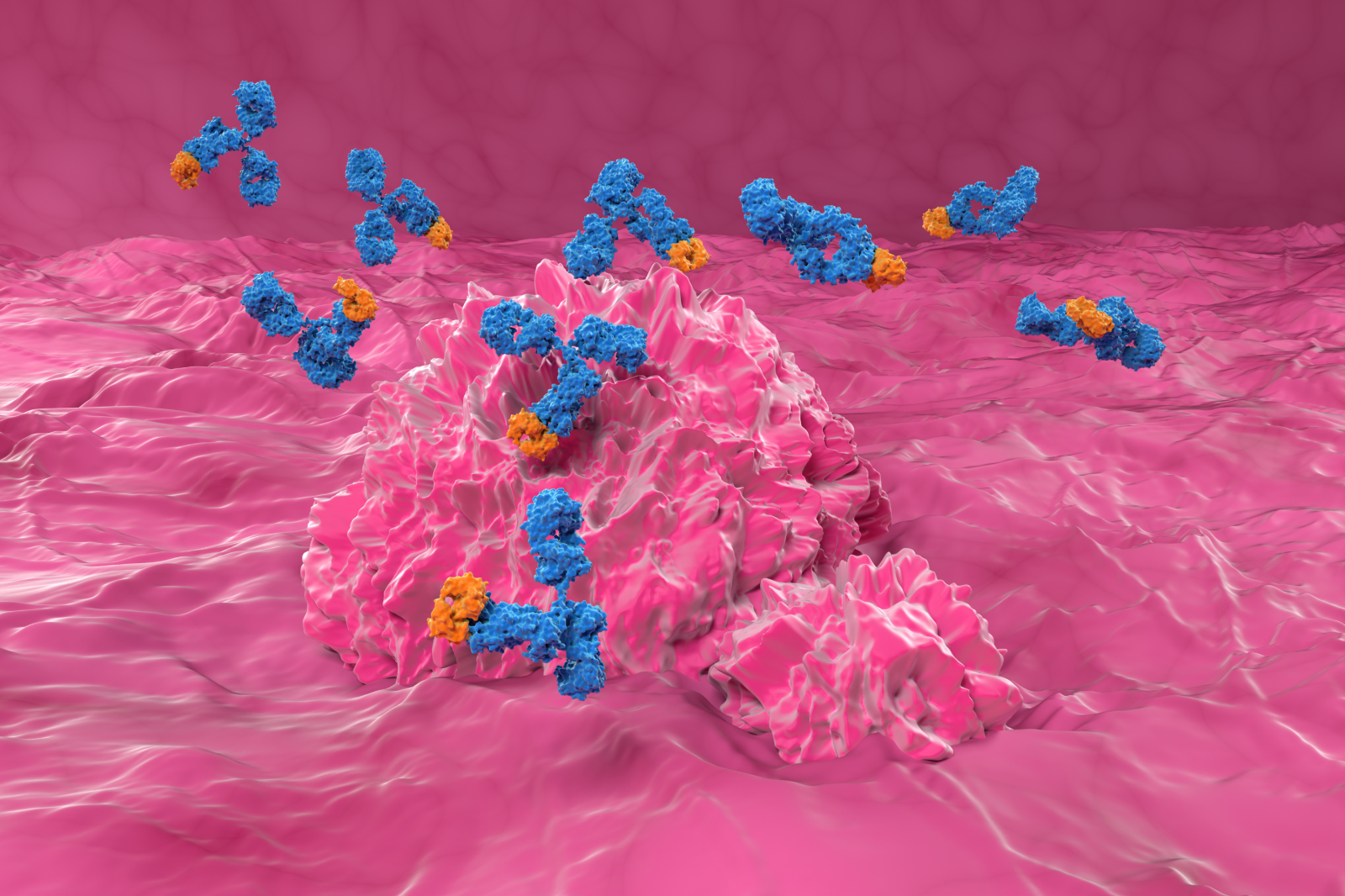 newsweek.com - Daniella Gray - Simple urine test can pick up 9 in 10 bladder cancers