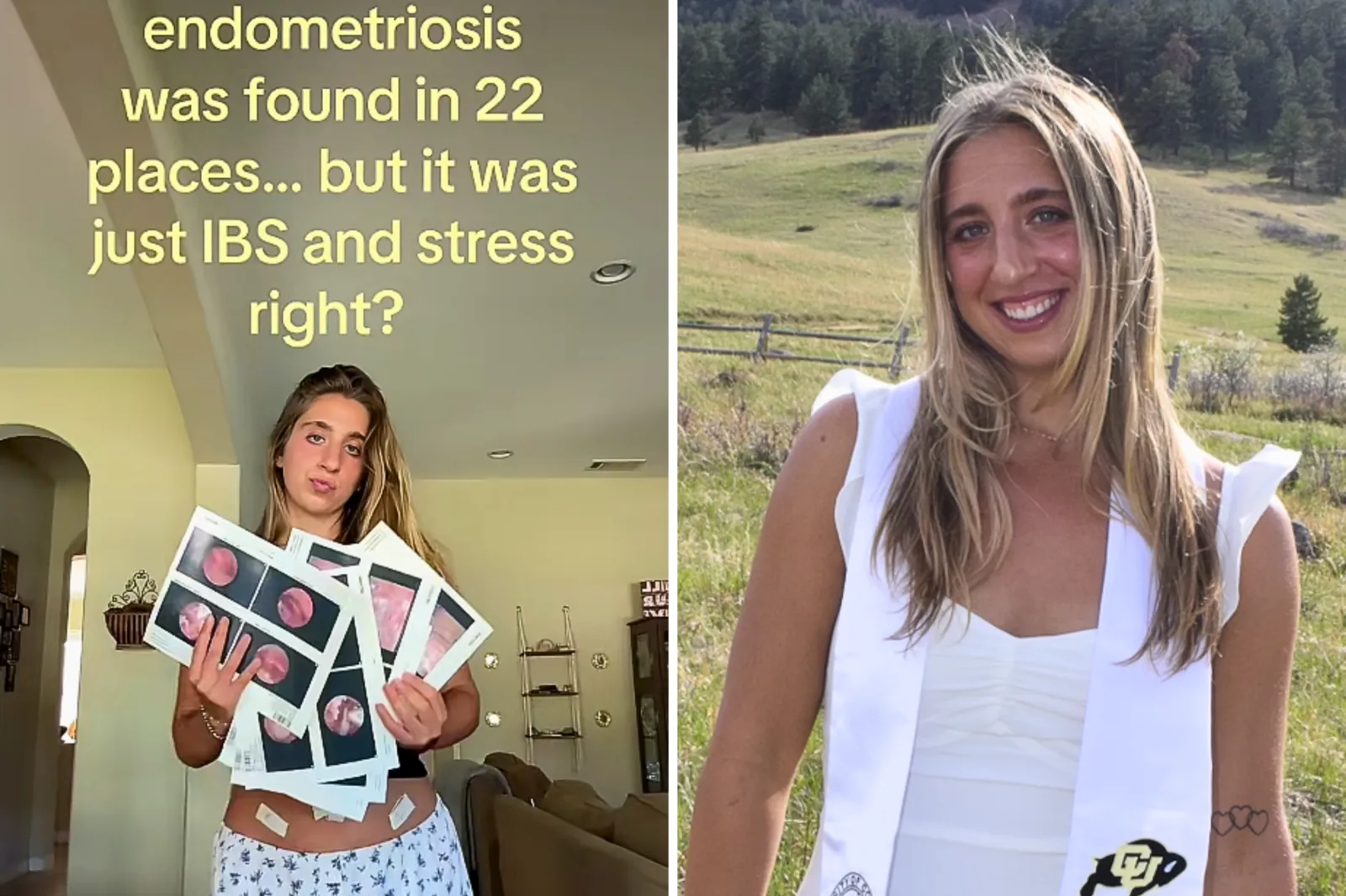 From left: Ally Ostedt in a TikTok video; and at her college graduation ceremony.
