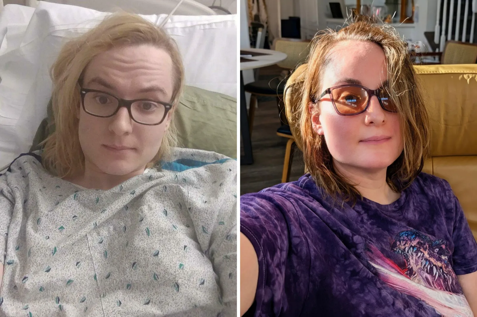 The Hidden Cost of Transitioning: How Hormone Therapy May Have Saved My Life
