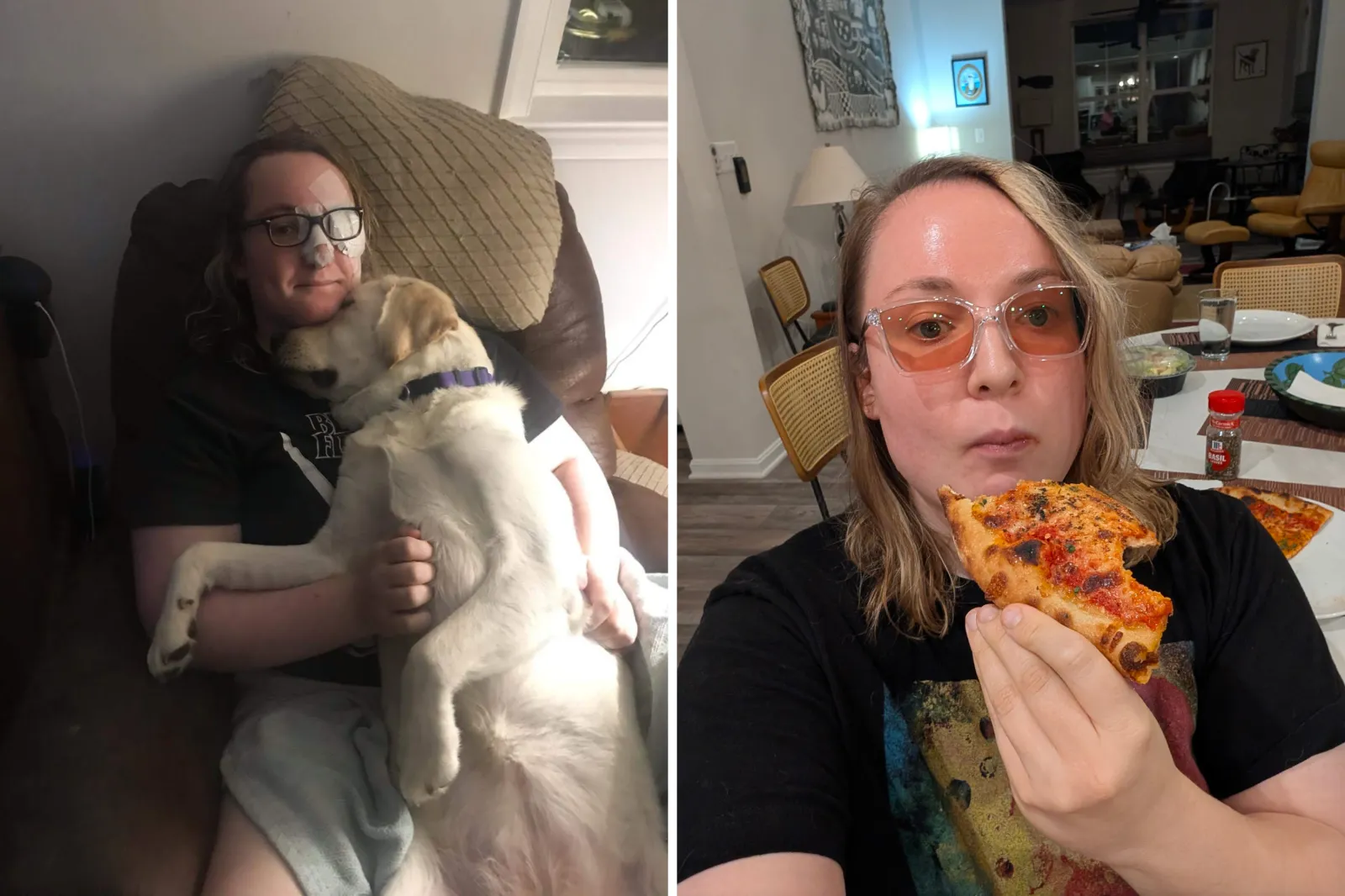 Trefzger with a bandage over her eye after suffering a rare stroke. Jenny eating pizza.