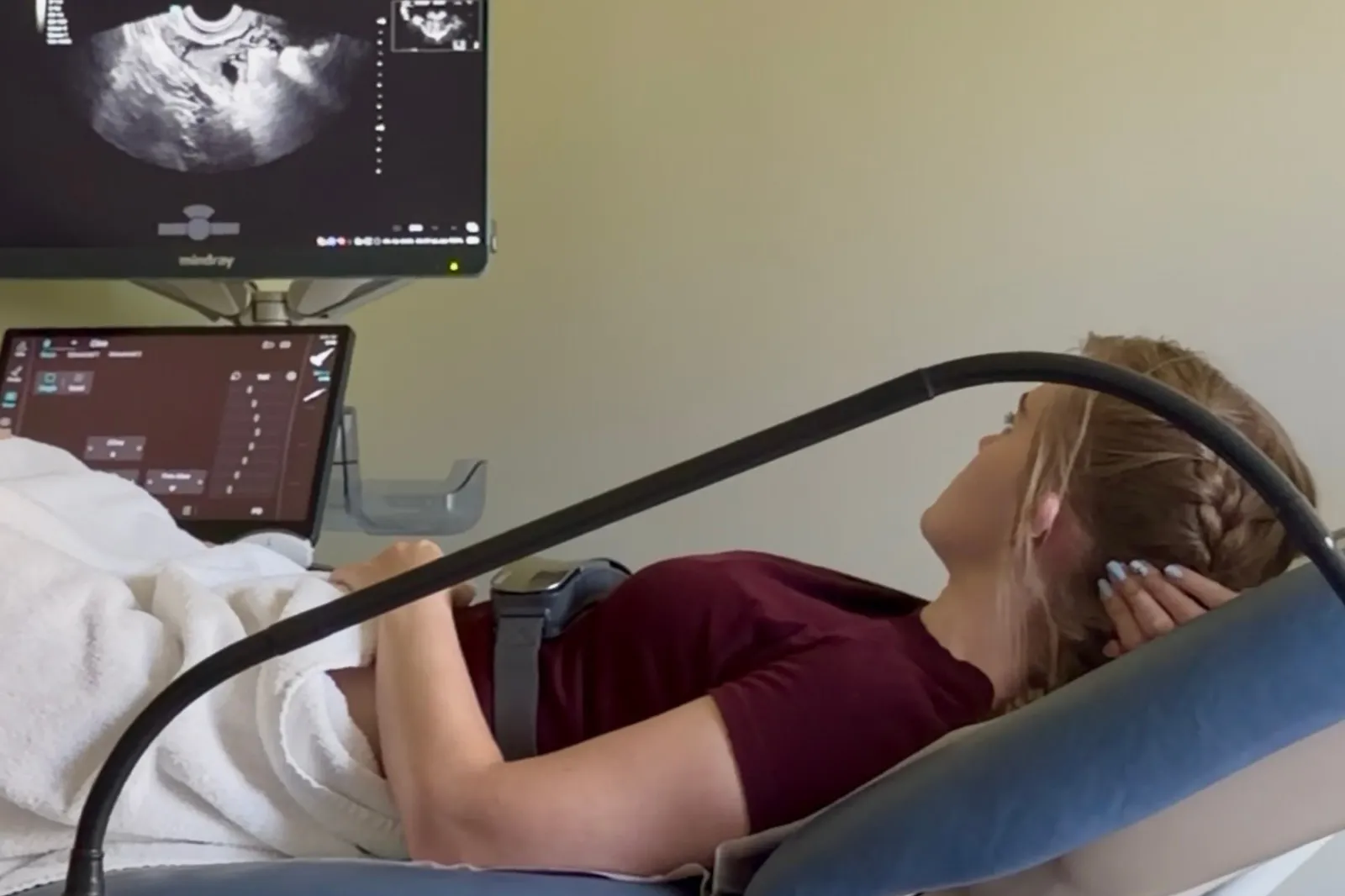 Wings lies on a hospital bed looking at a scan of her reproductive system.