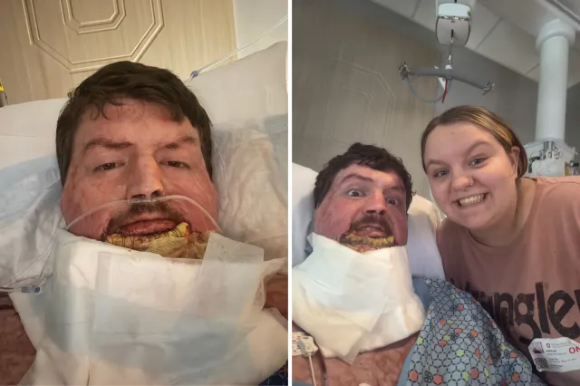 From left: Remington Weckbacher lies in hospital after the explosion; and smiles with his partner, Emma.