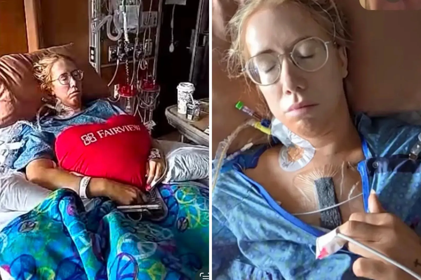 Ashley Veen in hospital after open heart surgery.