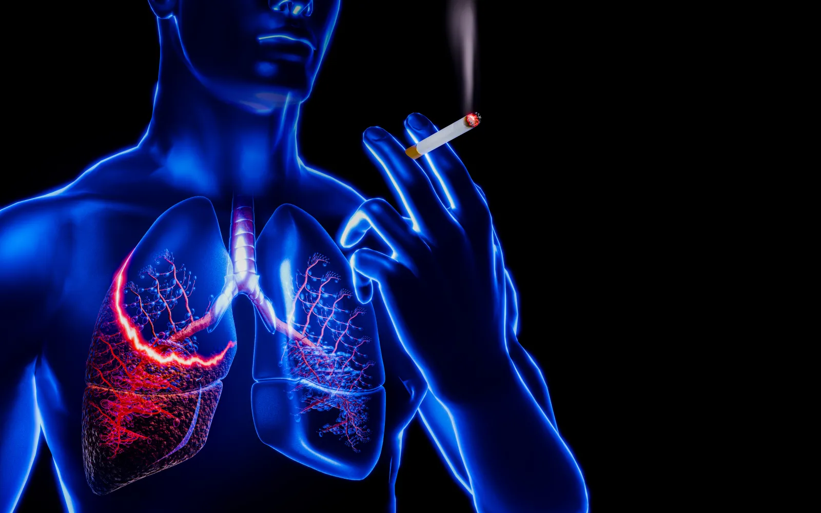 Stock illustration visualizing the damage of smoking to the lungs.