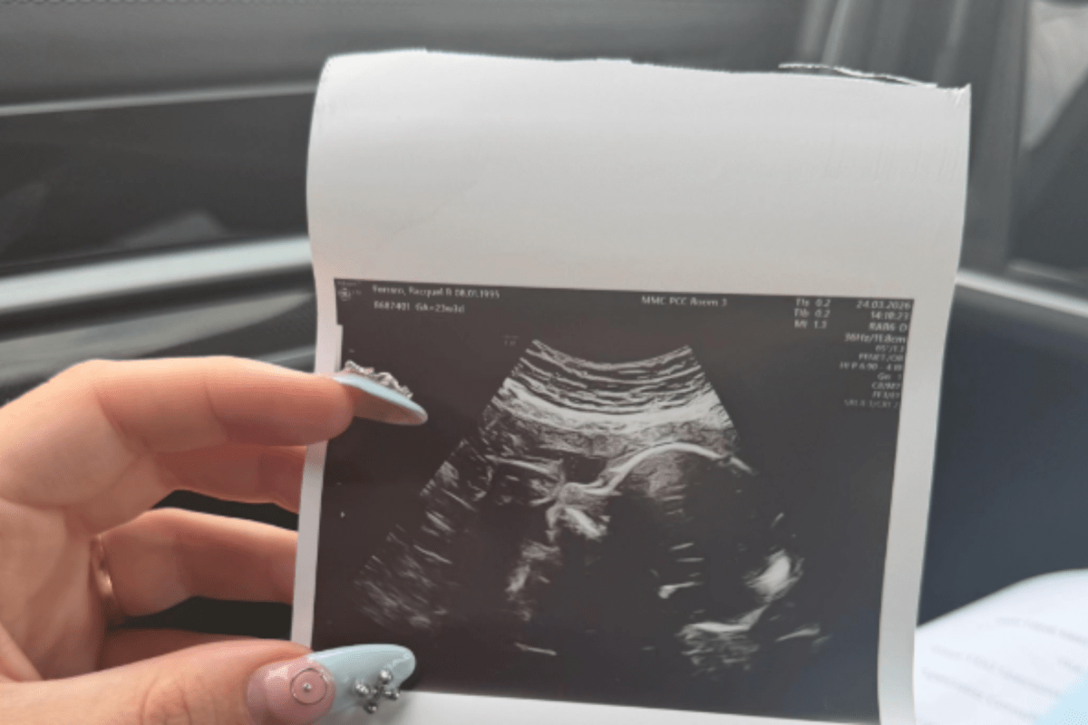 Woman Excited for Baby Scan, Then Comes News She Never Expected