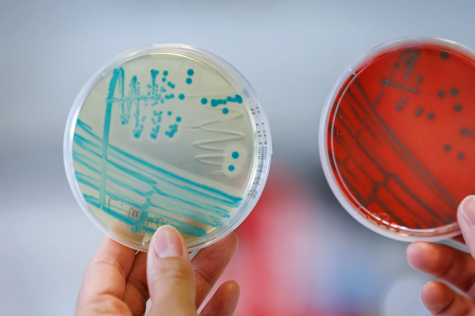A laboratory employee holds indicator culture plates at the Bavarian State Office for Health and Food Safety (LGL) on which Listeria monocytogenes colonies can be seen.