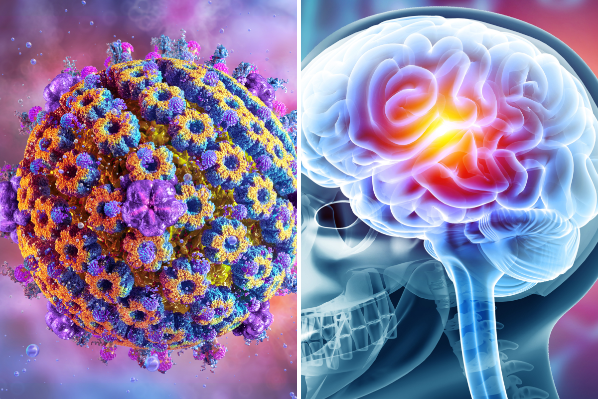 Virus Affecting 60 Percent of People May Hold Clues to Alzheimer’s Risk