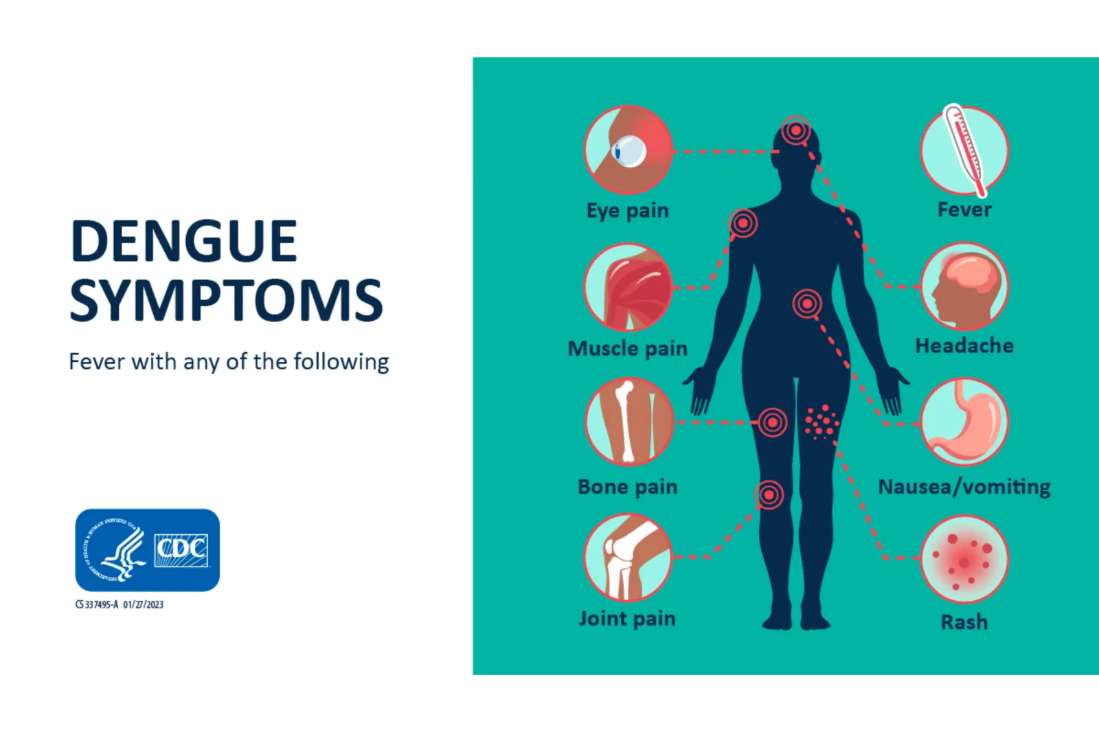 Diagram showing the symptoms of dengue fever