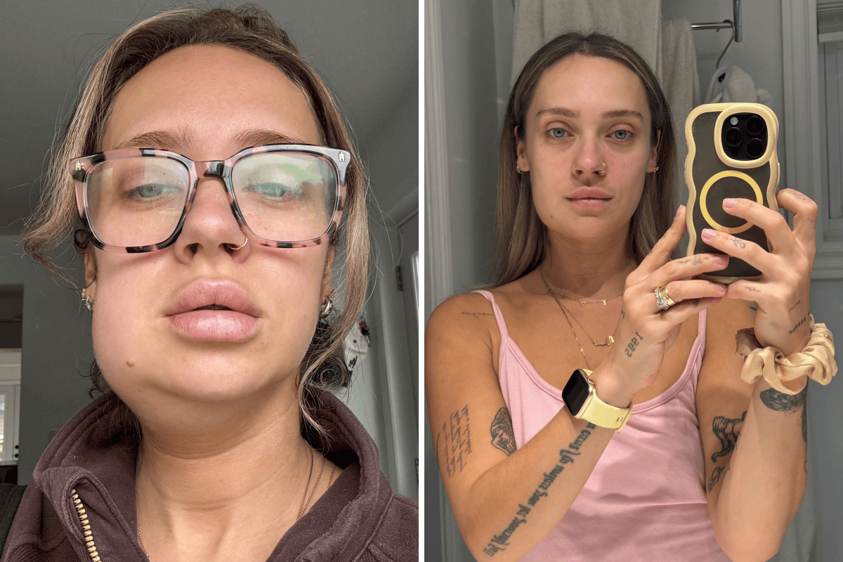 Woman Had Wisdom Tooth Removed—Days Later Comes Terrifying Diagnosis