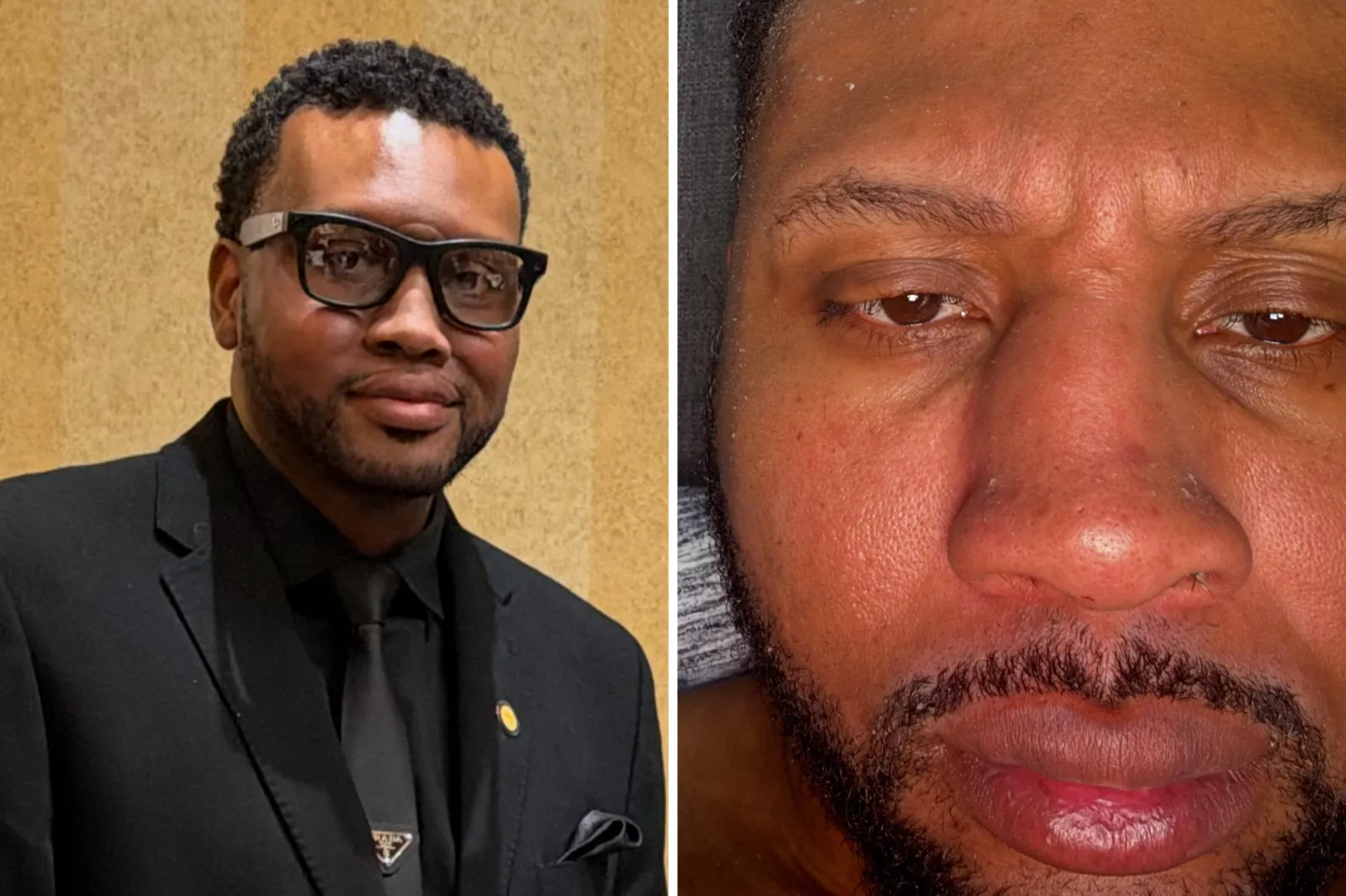From left: Dewayne Sutton smiling and taking a close-up of his swollen nose.