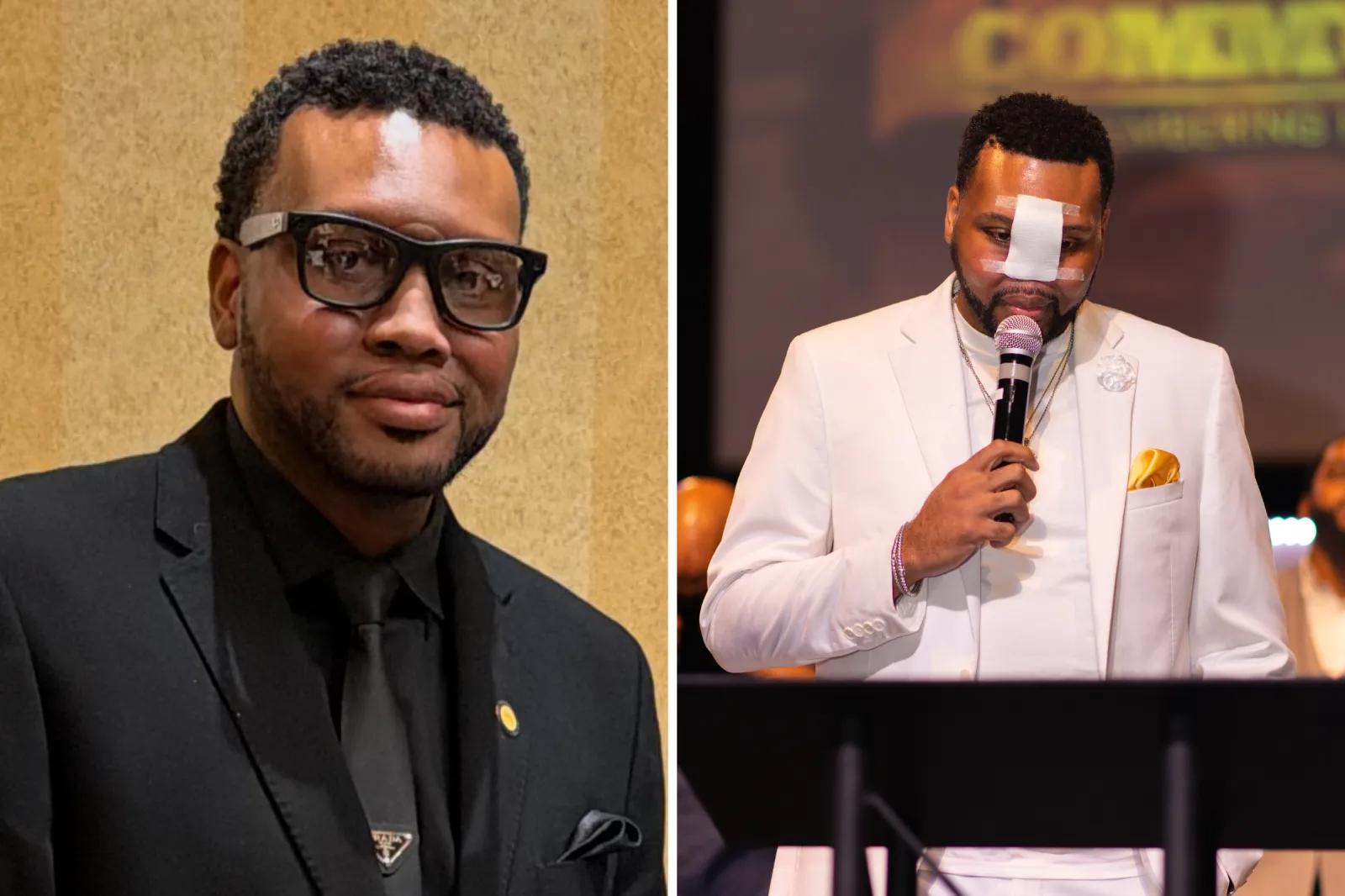 Dr. Alfred Dewayne Sutton before and after a total rhinectomy.