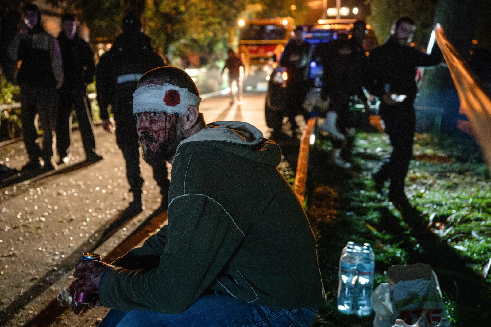 A wounded resident sits at the site of a Russian missile strike at an apartment building in Kyiv on October 14, 2026.