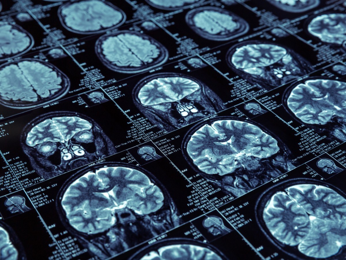 Scientists Investigated People With Insomnia. A Health Risk Pattern Emerged Scientists Investigated People With Insomnia. A Health Risk Pattern Emerged